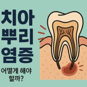 치아 뿌리 염증