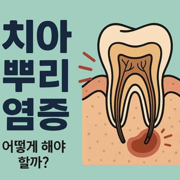 치아 뿌리 염증