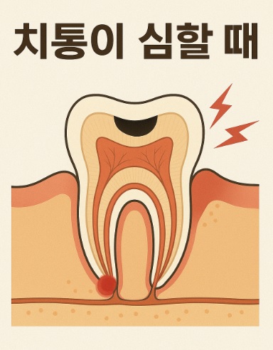치통이 심할때