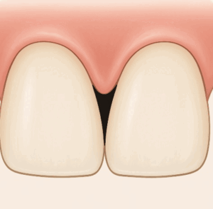 블랙트라이앵글